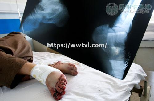 马赛球员遭遇车祸,伤势尚待公布 马赛球员遭遇车祸,伤势尚待公布